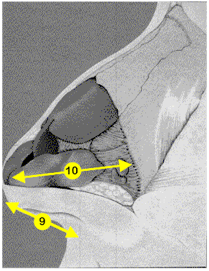 Illustration of tip tilt factors