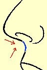 Illustration of relationship between nose shortening and tip position