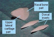 Photo of the original version of the Medpor Nasal Shell with inserts