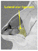 Diagram of lateral alar ligament